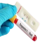 troponin-i.webp
