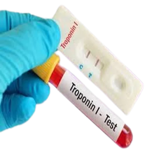 TROPININ I TEST CASSETTE (WB/S/P) CTNI 25'S